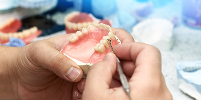 Dentist Or Orthodontist Makes A Ceramic Imprint Of The Jaw.
