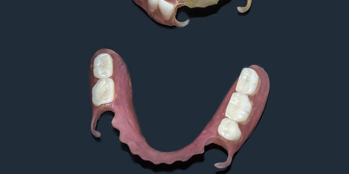 Removable Dentures Flexible, Devoid Of Nylon, Hypoallergenic Exe