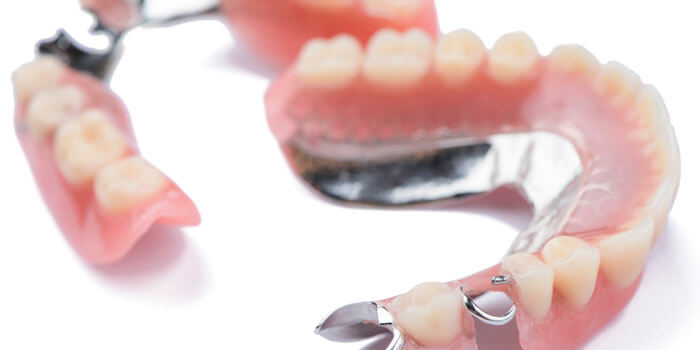 Close Up Metal Removable Partial Denture On White Background