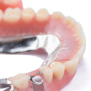 Partials