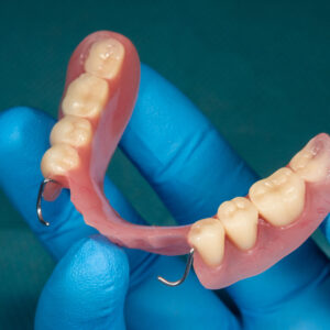 Close Up Human Denture Of The Upper Jaw On A Blue Background In The Hand Of A Dentist Wearing A Medical Glove